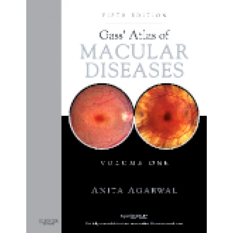 Gass' Atlas of Macular Diseases, 5th Edition